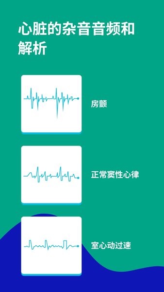 心电图ECG软件2