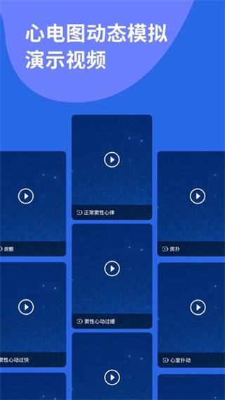 心电图ECG软件3